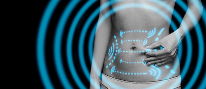 cryolipolisis woman treatment zones